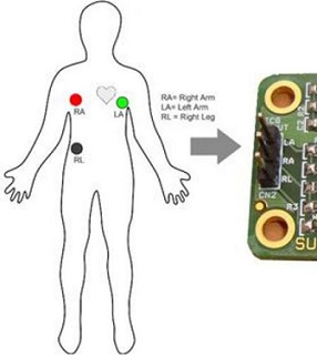 https://alashed-media.s3.eu-north-1.amazonaws.com/wiki/digitrode/860-arduino-i-ekg-kardiograf-svoimi-rukami/images/arduino-i-ekg-kardiograf-1.jpg
